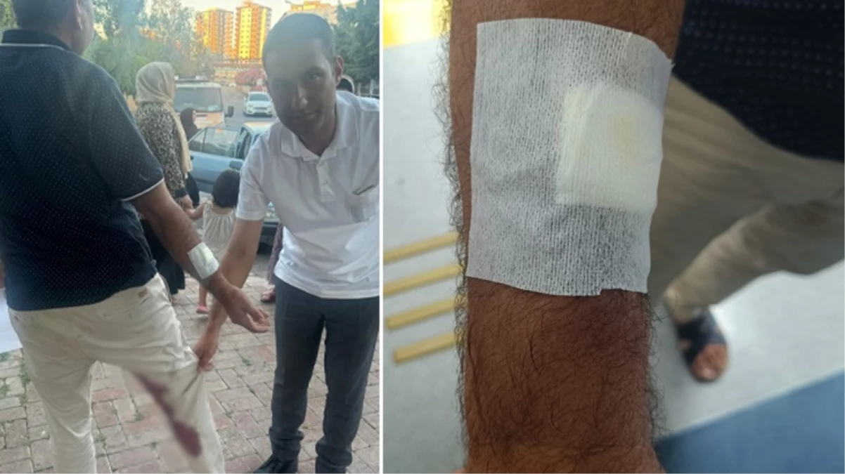 Şanlıurfa 'da kuduz köpeğin ısırdığı adam karantinaya alındı